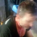 «Ρομά μου άνοιξαν το κεφάλι,έχω 12 ράμματα», λέει ο εστιάτορας που ξυλοκοπήθηκε από πελάτες